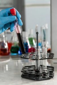 What Causes Chronic Venous Insufficiency?